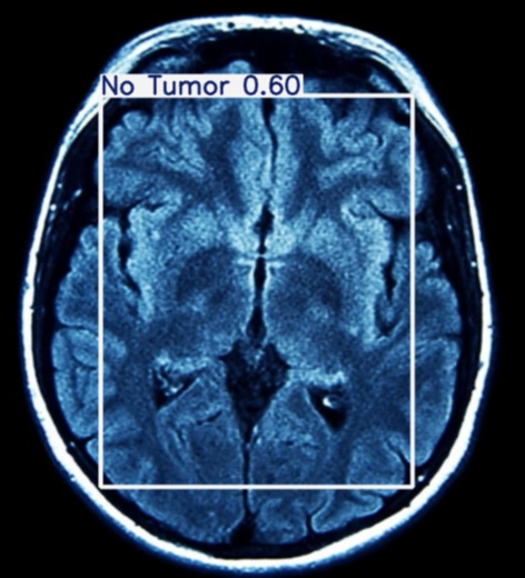 After Detection 4