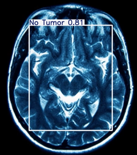 After Detection 5