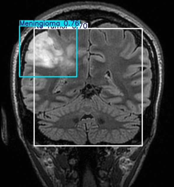 After Detection 1