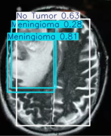After Detection 3